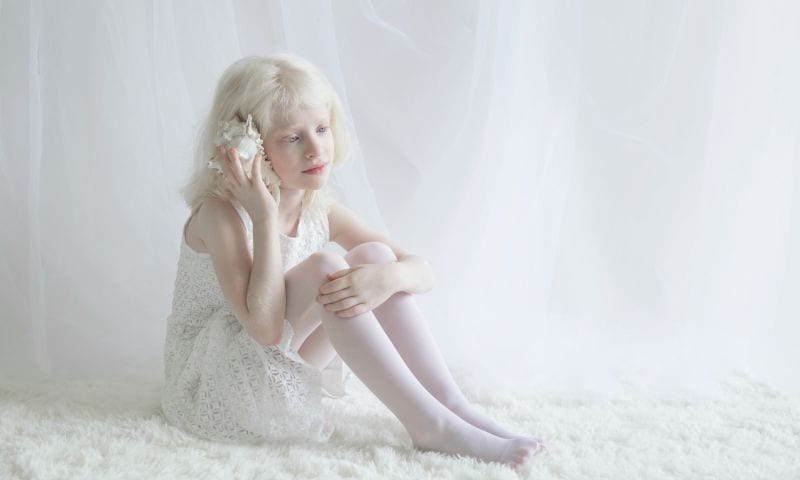 yulia-taits-albinos-10