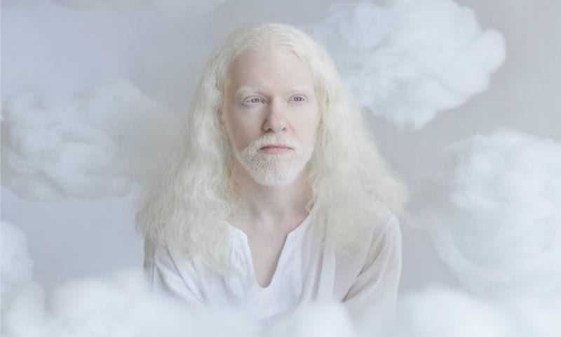 yulia-taits-albinos-4