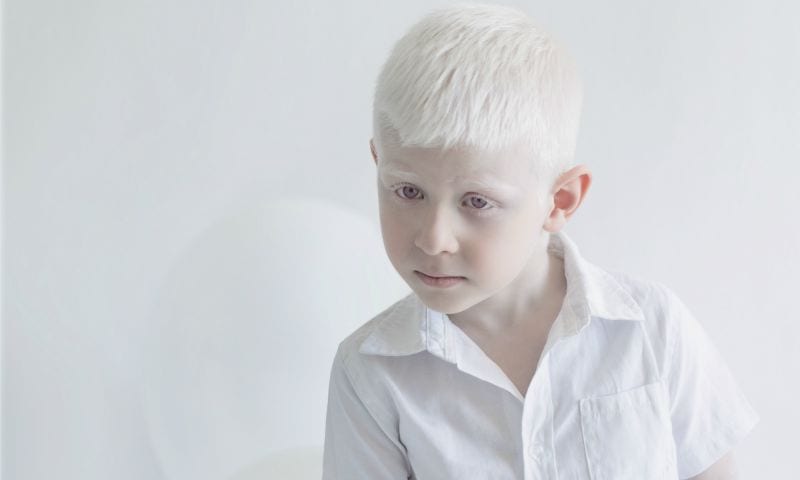 yulia-taits-albinos-9