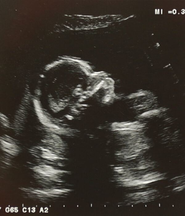 Schwangerschaft Abtreibung Abbruch Information
