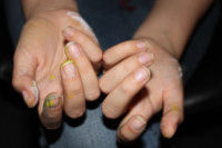 Hassobjekt schmutzige Fingernägel